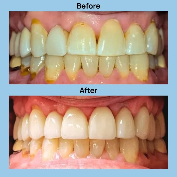 Dental Care at Lakeshore Family Dentistry in Oakland, California