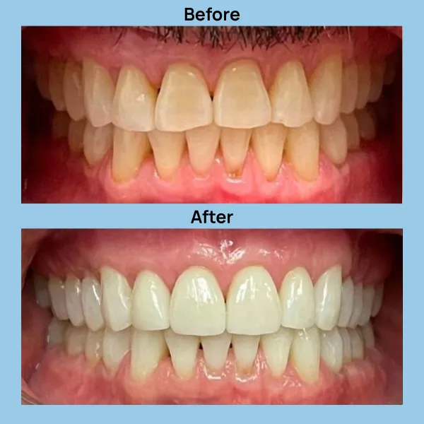 Dental Care at Lakeshore Family Dentistry in Oakland, California