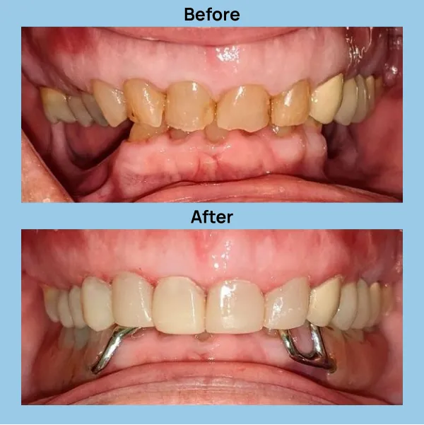 Dental Care at Lakeshore Family Dentistry in Oakland, California